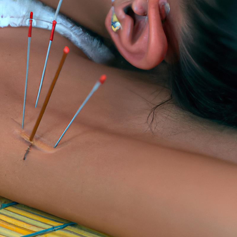 Akupunktura: Nové výzkumné studie potvrdily její účinnost. - foto 2