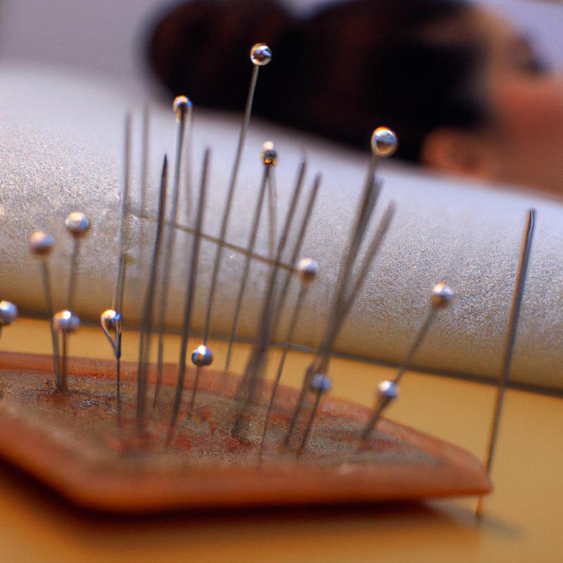 Akupunktura: Nové výzkumné studie potvrdily její účinnost. - foto 3